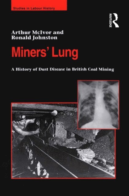 Ronald Johnston, Arthur McIvor - Miners' Lung, E-bok