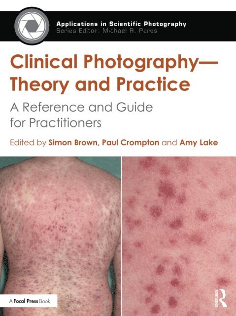 Amy Lake, Paul Crompton, Simon Brown - Clinical Photography - Theory and Practice, E-bok