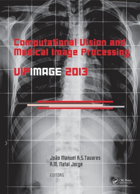 Jorge R.M. Natal, Joao Manuel RS Tavares - Computational Vision and Medical Image Processing IV, E-bok