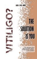Vitiligo? The solution is you