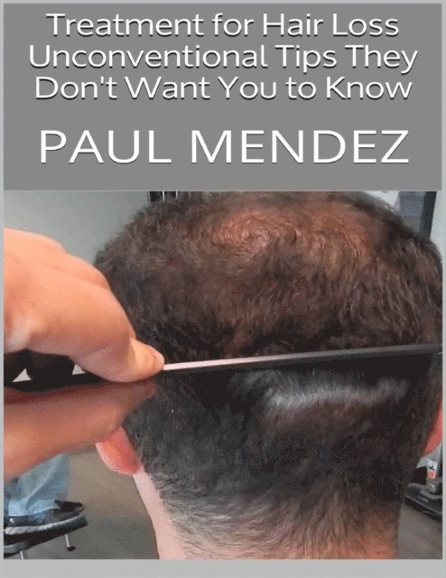Paul Mendez - Treatment for Hair Loss: Unconventional Tips They Don't Want You to Know, E-bok