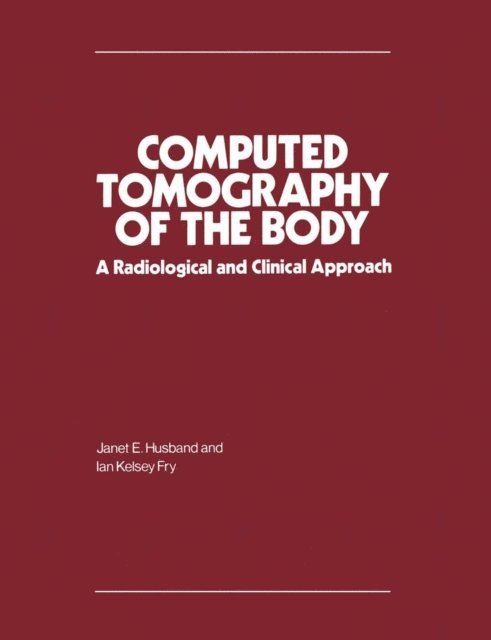 Ian Kelsey Fry, Janet E. Husband - Computed Tomography of the Body, E-bok. Tillgänglighet: Lägg i varukorg