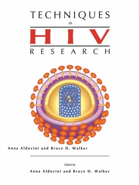 Bruce Walker, Anna Aldovini - Techniques in HIV Research, E-bok