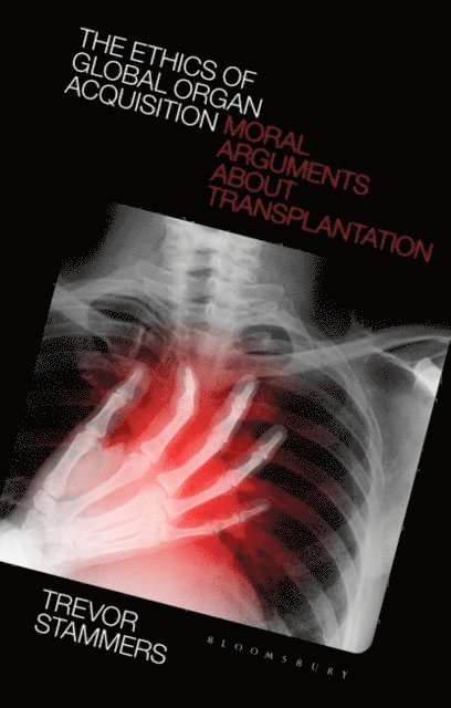 Trevor Stammers - Ethics of Global Organ Acquisition, E-bok
