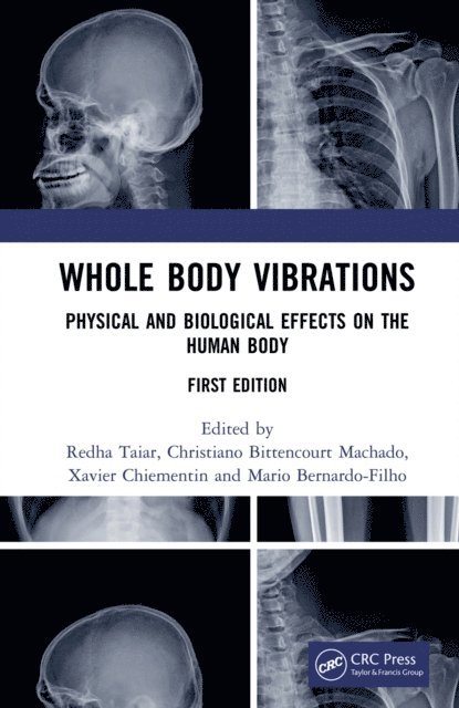 Mario Bernardo-Filho, Xavier Chiementin, Christiano Bittencourt Machado, Redha Taiar - Whole Body Vibrations, E-bok