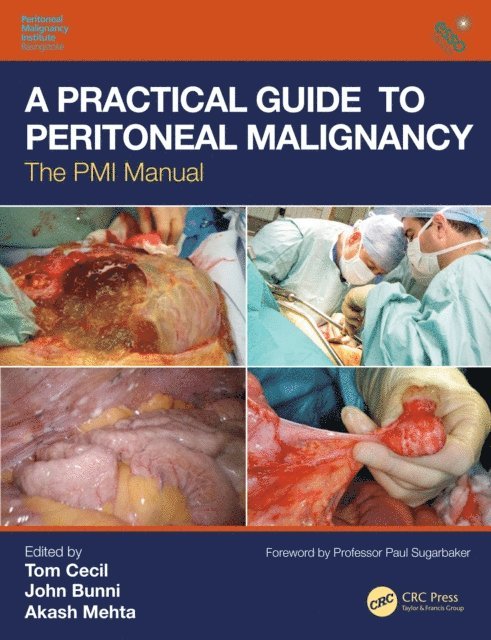 Akash Mehta, John Bunni, Tom Cecil - Practical Guide to Peritoneal Malignancy, E-bok
