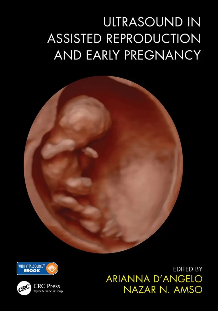 Arianna D'Angelo, Nazar N. Amso - Ultrasound in Assisted Reproduction and Early Pregnancy, E-bok. Tillgänglighet: Lägg i varukorg