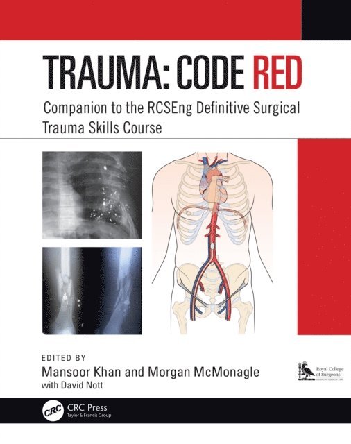 Morgan McMonagle, Mansoor Khan - Trauma: Code Red, E-bok