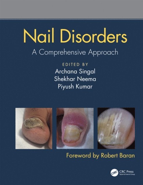 Piyush Kumar, Shekhar Neema, Archana Singal - Nail Disorders, E-bok