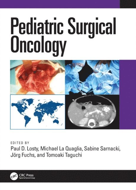 Tomoaki Taguchi, Jorg Fuchs, Sabine Sarnacki, Michael La Quaglia, Paul D. Losty - Pediatric Surgical Oncology, E-bok