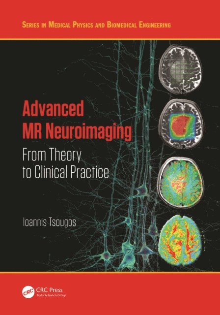 Ioannis Tsougos - Advanced MR Neuroimaging, E-bok. Tillgänglighet: Lägg i varukorg