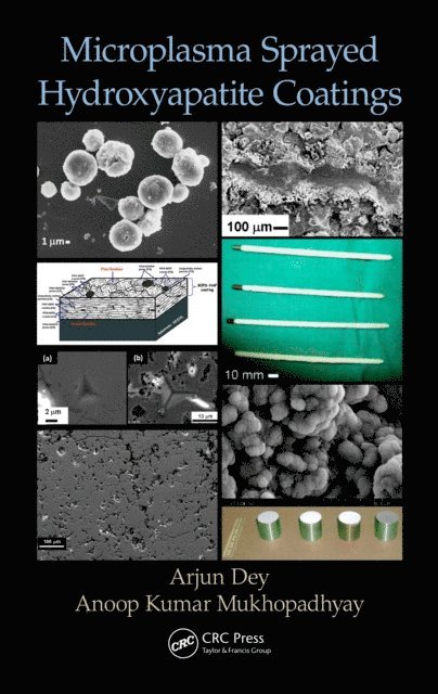 Anoop Kumar Mukhopadhyay, Arjun Dey - Microplasma Sprayed Hydroxyapatite Coatings, E-bok