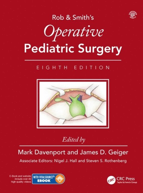 James Geiger, Mark Davenport - Operative Pediatric Surgery, E-bok