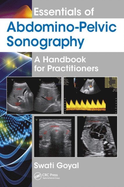 Swati Goyal - Essentials of Abdomino-Pelvic Sonography, E-bok. Tillgänglighet: Lägg i varukorg