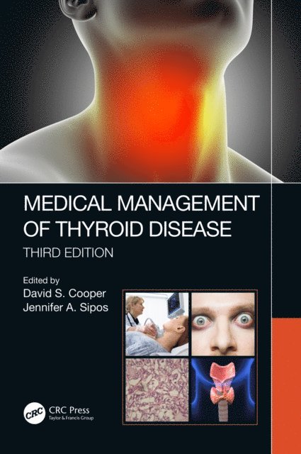 Jennifer Sipos, David S. Cooper - Medical Management of Thyroid Disease, Third Edition, E-bok