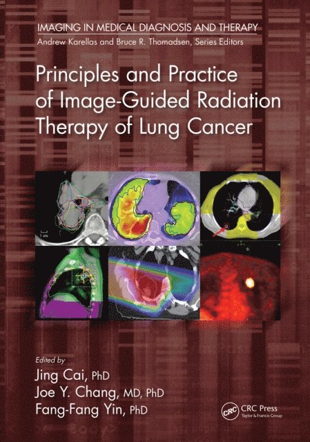 Fang-Fang Yin, Joe Y. Chang, Jing Cai - Principles and Practice of Image-Guided Radiation Therapy of Lung Cancer, E-bok