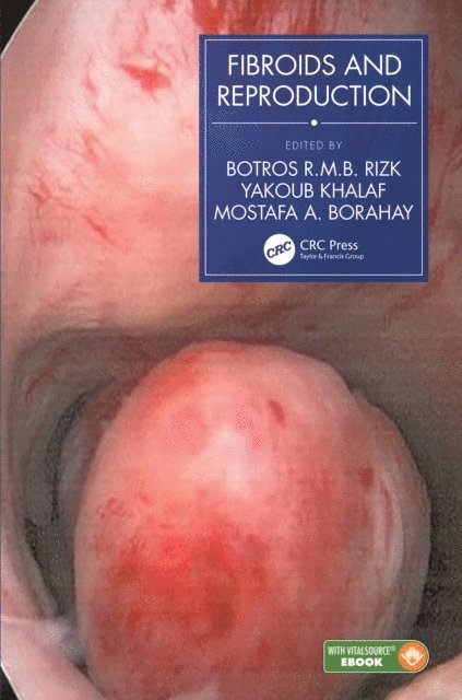 Mostafa A. Borahay, Yakoub Khalaf, Botros R.M.B. Rizk - Fibroids and Reproduction, E-bok