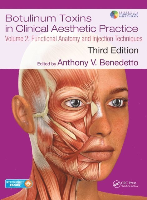 Anthony V Benedetto - Botulinum Toxins in Clinical Aesthetic Practice 3E, Volume Two, E-bok