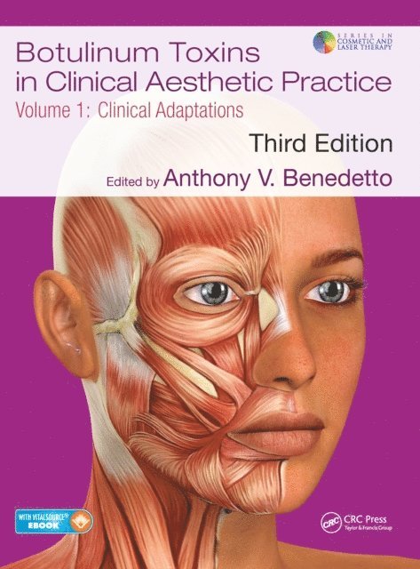 Anthony V Benedetto - Botulinum Toxins in Clinical Aesthetic Practice 3E, Volume One, E-bok