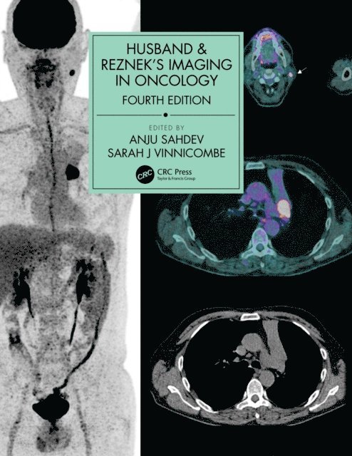 Sarah J. Vinnicombe, Anju Sahdev - Husband & Reznek's Imaging in Oncology, E-bok