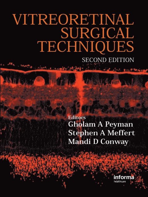 Gholam A. Peyman - Vitreoretinal Surgical Techniques, Second Edition, E-bok