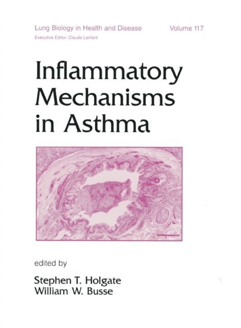 Stephen Holgate - Inflammatory Mechanisms in Asthma, E-bok