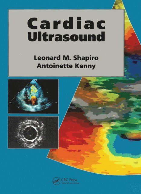 Antoinette Kenny, Leonard Shapiro - Cardiac Ultrasound, E-bok