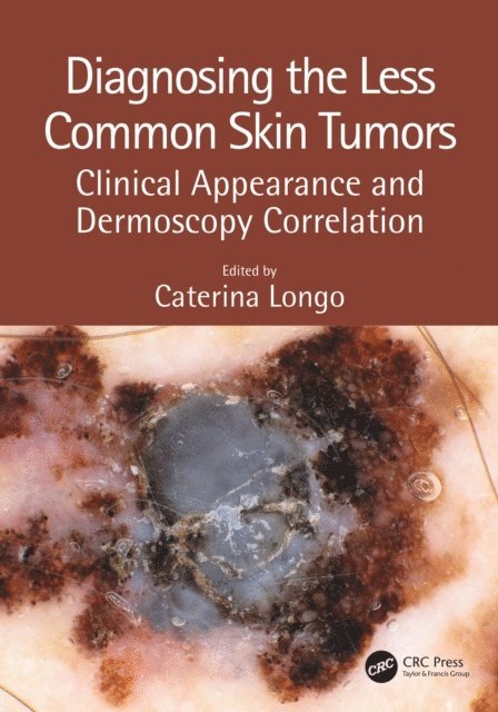Caterina Longo - Diagnosing the Less Common Skin Tumors, E-bok