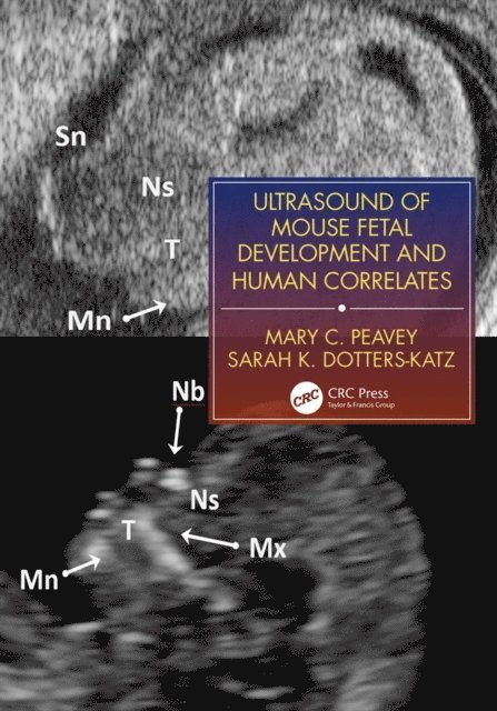 Sarah K. Dotters-Katz, Mary C. Peavey - Ultrasound of Mouse Fetal Development and Human Correlates, E-bok