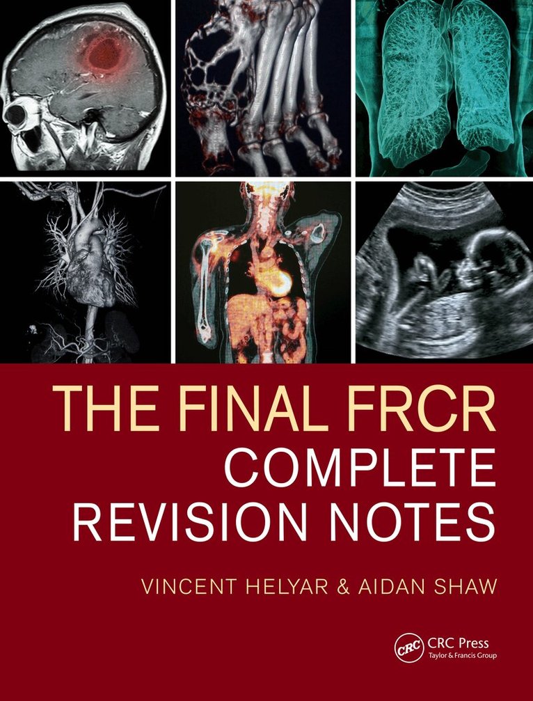 Vincent Helyar, Aidan Shaw - Final FRCR, E-bok