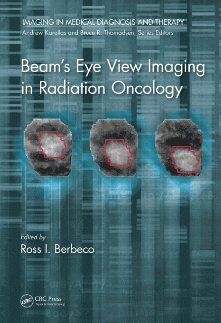 Ph.D. Berbeco - Beam's Eye View Imaging in Radiation Oncology, E-bok