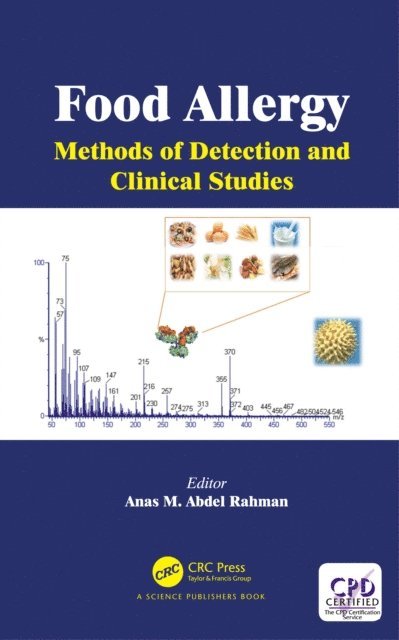 Anas M. Abdel Rahman - Food Allergy, E-bok