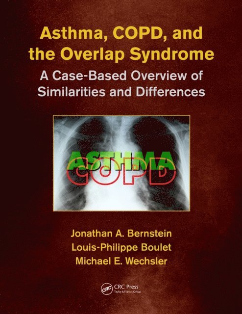 MD,MMSc Michael E. Wechsler, Louis-Philippe Boulet, Jonathan A. Bernstein - Asthma, COPD, and Overlap, E-bok