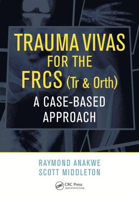 Scott Middleton, Raymond Anakwe - Trauma Vivas for the FRCS, E-bok