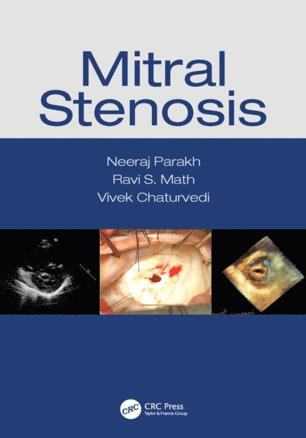 Vivek Chaturvedi, Ravi S Math, Neeraj Parakh - Mitral Stenosis, E-bok