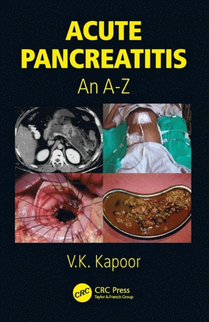 V.K. Kapoor - Acute Pancreatitis, E-bok. Tillgänglighet: Lägg i varukorg