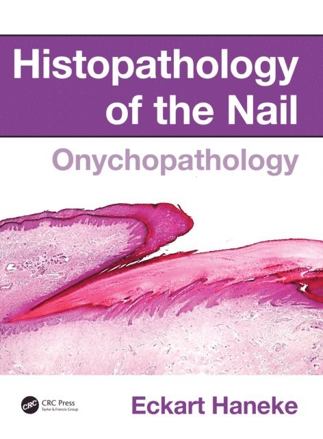 Eckart Haneke - Histopathology of the Nail, E-bok