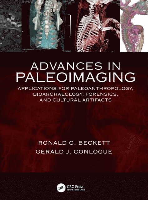 Ronald G. Beckett, Gerald J. Conlogue - Advances in Paleoimaging, E-bok