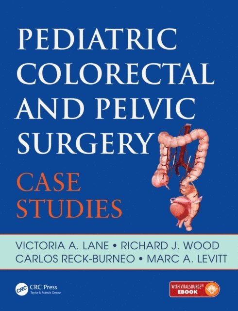 Carlos Reck, Richard Wood, Victoria Lane, Marc Levitt - Pediatric Colorectal and Pelvic Surgery, E-bok