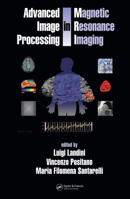 Maria Santarelli, Vincenzo Positano, Luigi Landini - Advanced Image Processing in Magnetic Resonance Imaging, E-bok