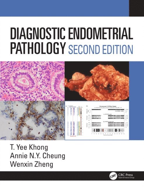 Wenxin Zheng, Annie NY Cheung, Yee Khong - Diagnostic Endometrial Pathology 2E, E-bok