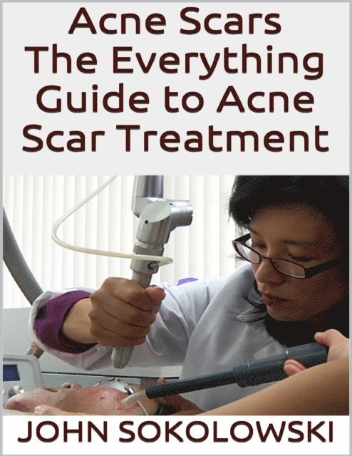 John Sokolowski - Acne Scars: The Everything Guide to Acne Scar Treatment, E-bok