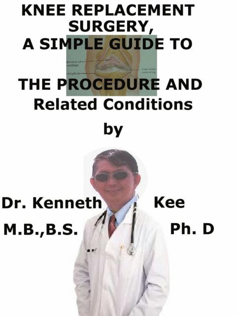 Knee Replacement Surgery, A Simple Guide To The Procedure And Related Conditions