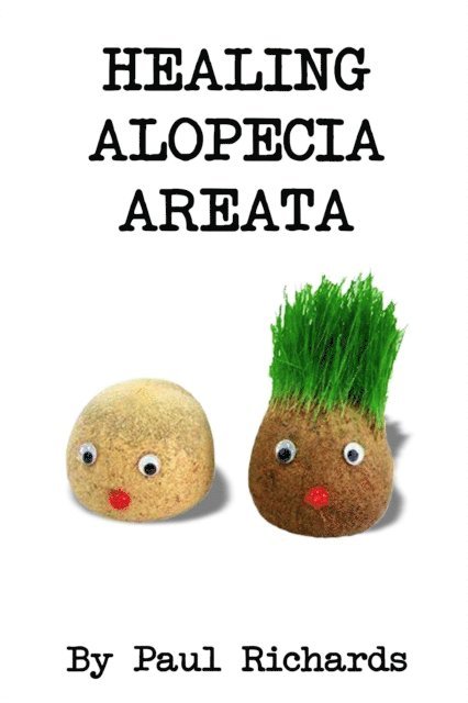 Paul Richards - Healing Alopecia Areata, E-bok