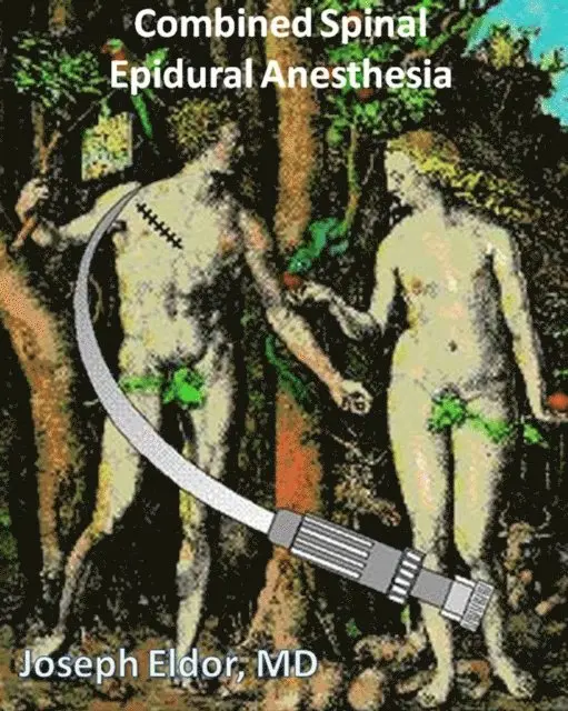 Joseph Eldor - Combined Spinal-Epidural Anesthesia, E-bok. Tillgänglighet: Lägg i varukorg
