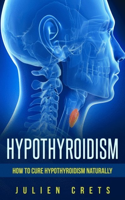 How to treat hypothyroidism naturally