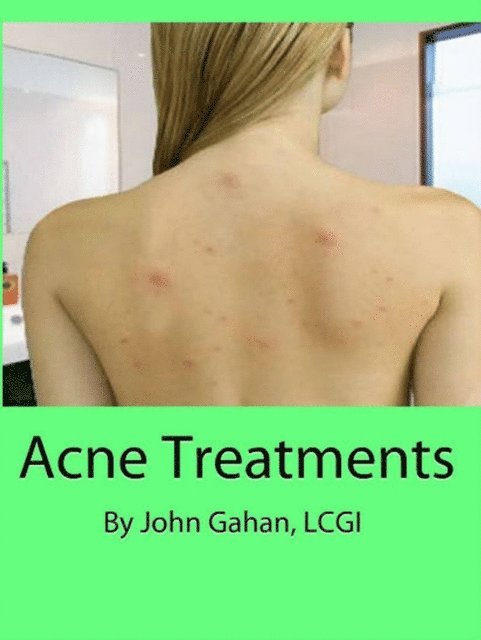 LCGI John Gahan - Acne Treatments, E-bok. Tillgänglighet: Lägg i varukorg