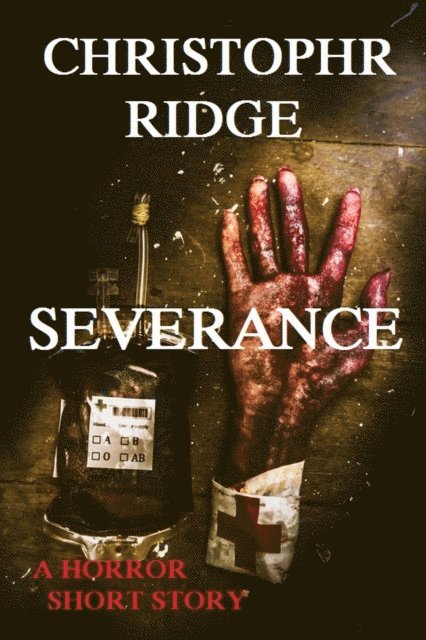 Christopher Ridge - Severance, E-bok. Tillgänglighet: Lägg i varukorg