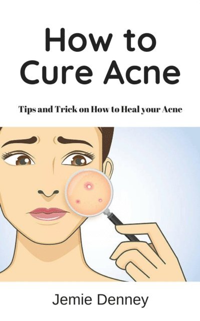 Jessica Lindsey - How to Cure Acne, E-bok