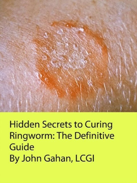 LCGI John Gahan - Hidden Secrets to Curing Ringworm: The Definitive Guide, E-bok. Tillgänglighet: Lägg i varukorg